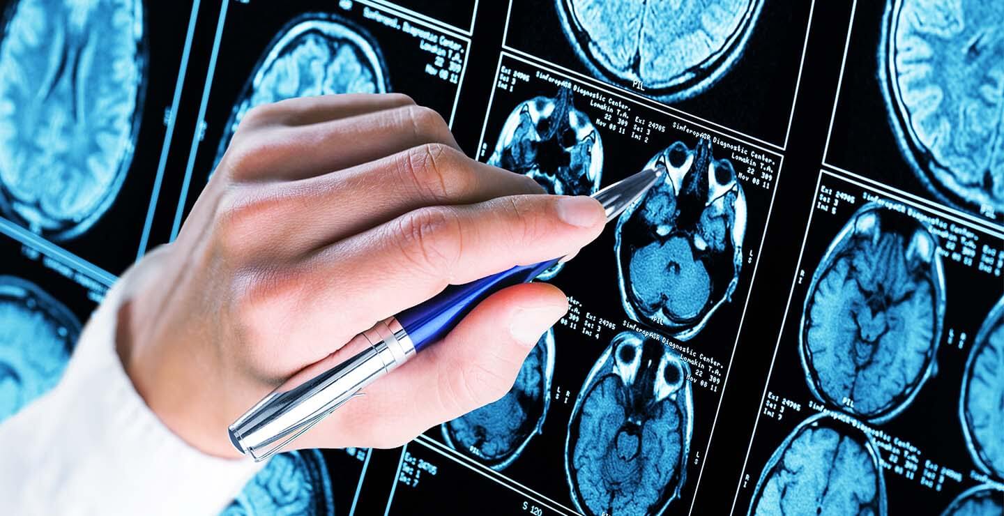Hand of a researcher pointing to a location on a brain scan