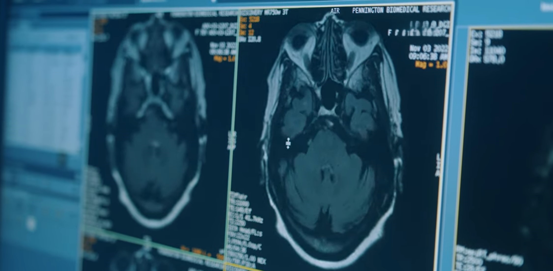 Brain scans