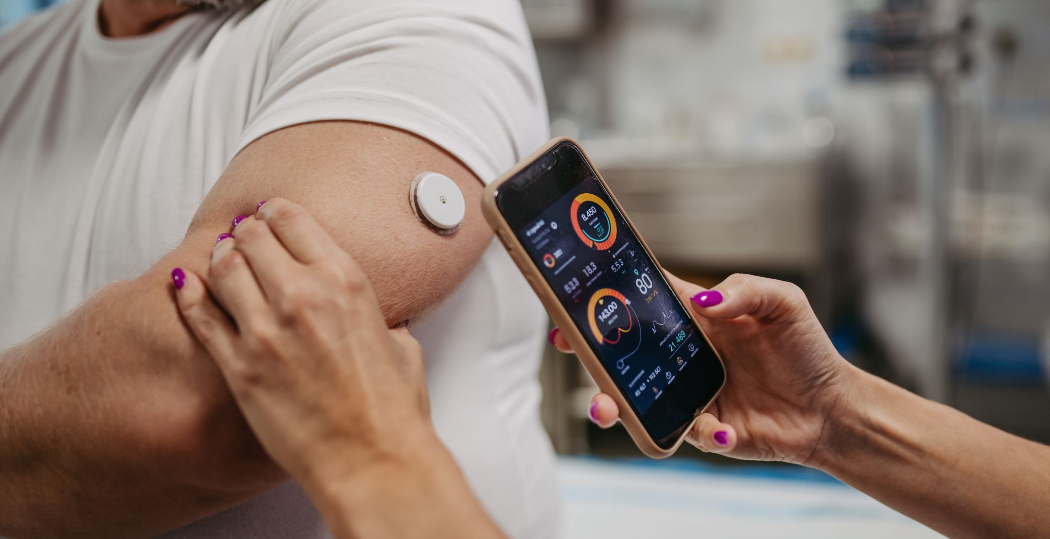 continuous glucose monitor