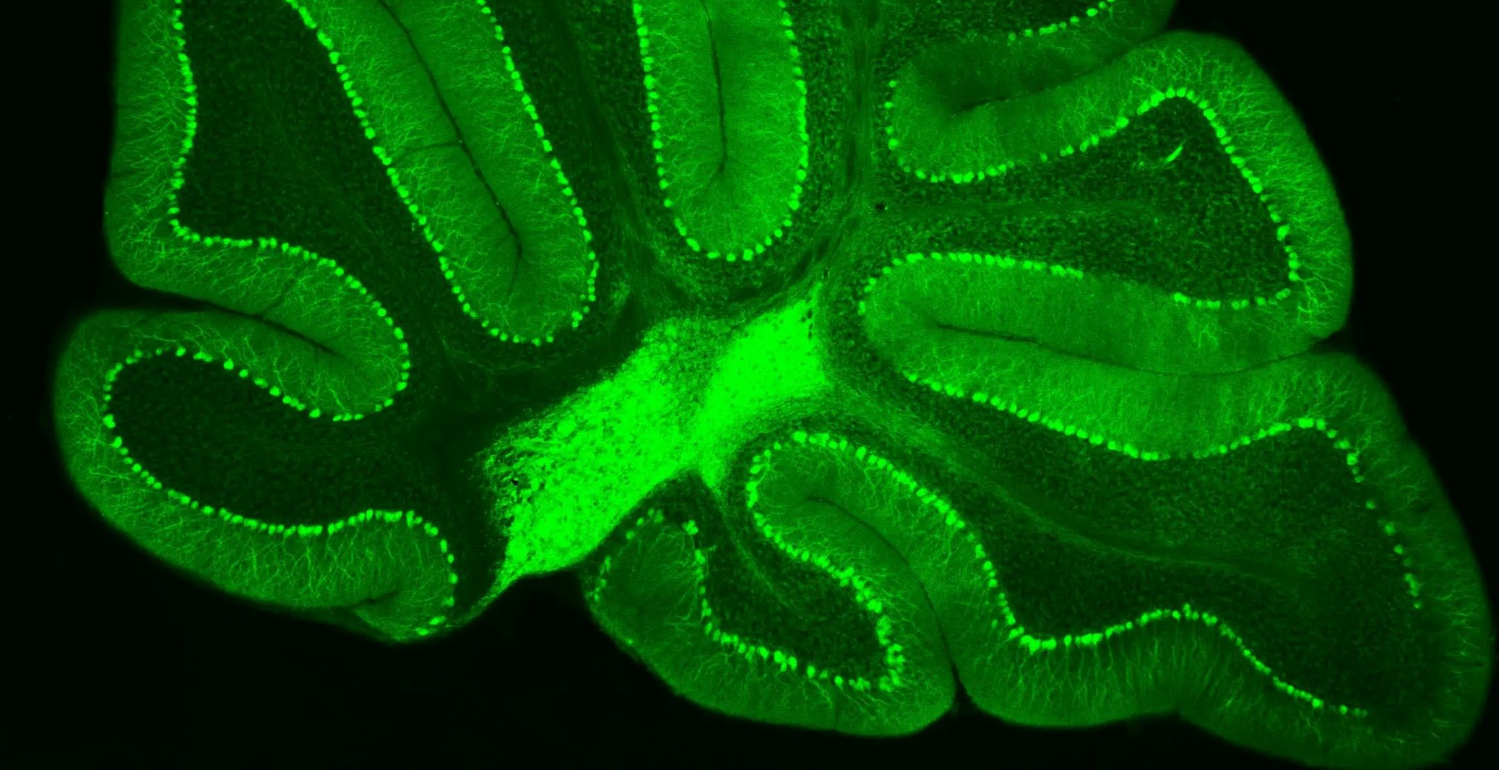 Green Neurons