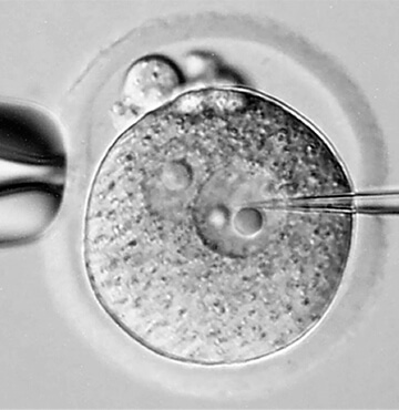 Pronuclear injection of mouse zygote